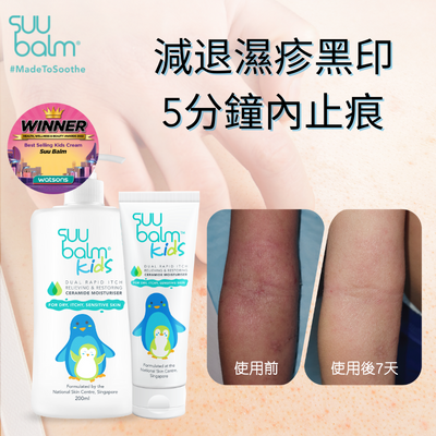 Suu Balm Kids濕疹保濕止痕&減退黑印