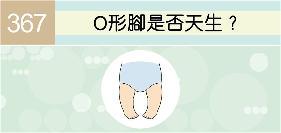 O形腳是否天生？