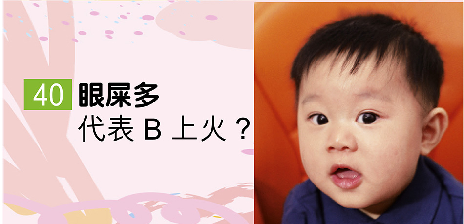 眼屎多代表B上火？